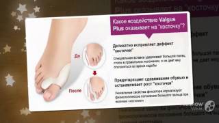 valgus plus купить в иркутске

  - Valgus Pro оригинал