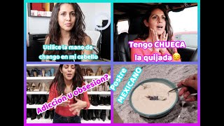 Me deshice de mi colección de zapatos?+ Usaré alineadores