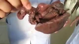 Anatomy of female genital organ