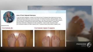 выпрямитель большого пальца стопы купить

  - Valgus Pro - средство от выпирающей «косточки»