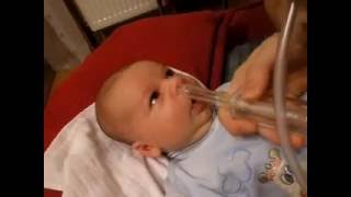 Burun aspiratörü Kullanımı Baby-Vac Dünyadan Zétény orrszívás