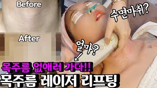 목주름 없애러 가자! | 목주름 레이저 시술 & 리뷰
