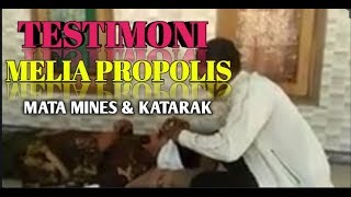Testimoni #Melia-Proplis /Tetes mata,Gurah mata