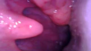 Deep inside female mouth