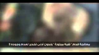 حملة الوفاء لأرض الشهداء الغوطة - فاصل 1