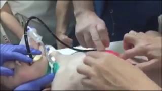 Мальчику провели сложную операцию