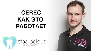 #Стоматолог Стас Белоус 3D ТЕХНОЛОГИЯ #CEREC ДЛЯ ЛЕЧЕНИЯ ЗУБОВ КАЖДЫЙ ДЕНЬ.