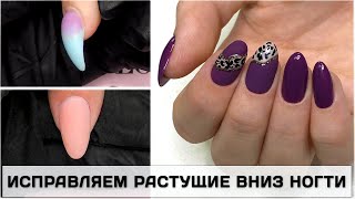Коррекция ГЕЛЕМ клюющего ногтя ✅Как исправить КЛЮЮЩИЙ НОГТЬ ✅КОРРЕКЦИЯ  вниз растущего ногтя гелем