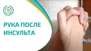 Реабилитолог Юрий Жидченко. Упражнения для руки после инсульта. Реабилитация. Рука после инсульта