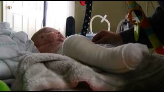 Baby Easton travels to special Epidermolysis Bullosa Center in Ohio