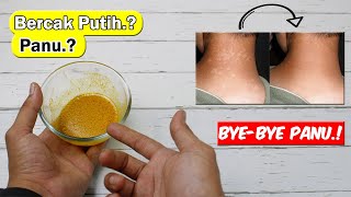TIDAK PERLU MENGGUNAKANOBAT, CUKUP PAKAI INI PANU DI BADAN HILANG TOTAL SECARA PERMANEN