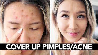 How To Cover Pimples/Acne - Makeup for Pimples || Sylvia Jade