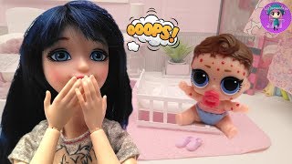 Bebé LOL tiene VARICELA y mamá Marinette la cuida