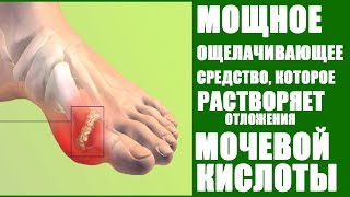 КАК ВЫВЕСТИ МОЧЕВУЮ КИСЛОТУ ИЗ ОРГАНИЗМА. ЛЕЧЕНИЕ ПОДАГРЫ НАРОДНЫМИ СРЕДСТВАМИ.