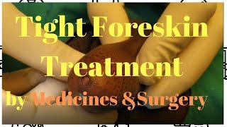 TIGHT FORESKIN TREATMENT &Circumcision Surgery DR.KUBER,PUNE +919370275336/9370240098