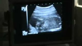 19 semanas, es niña!