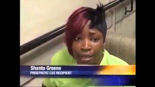 New Amputee Woman 370 - YouTube