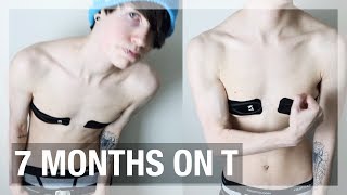 7 MONTHS ON T