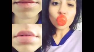 Увеличения губ Fullips  в Украине