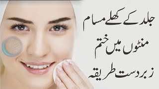 Face Beauty Tips In Urdu | Khule masam ka Ilaj