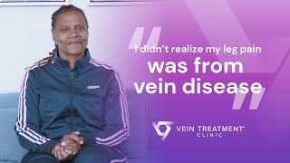 Spider and Varicose Veins Before & After | Spider and Varicose Vein Treatment Center