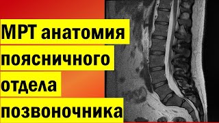 МРТ анатомия поясничного отдела позвоночника