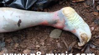 Body Farm