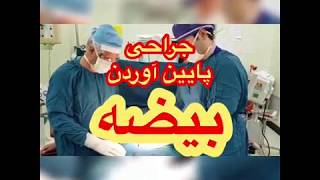 testicle repair surgery  جراحی پایین آوردن بیضه