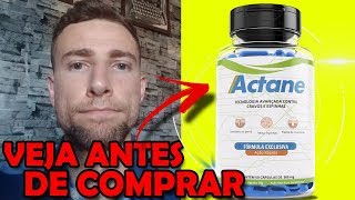 Actane Funciona? Como tomar o ACTANE? Qual prazo de entrega? Meu DEPOIMENTO sobre o ACNE