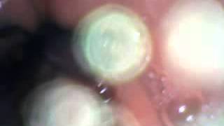 Vore Cam 31