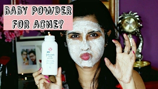 BABY POWDER FOR ACNE??? WTF| WEIRD HACK TESTED ||DebleenaBiswas