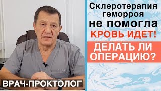 Склеротерапия геморроя не помогла! Латексное лигирование или дезартеризация геморроидальных узлов