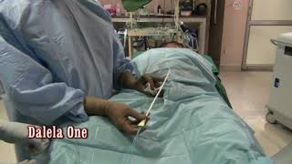 How to use DOSCUD for one stage dilatation of urethral stricture in male