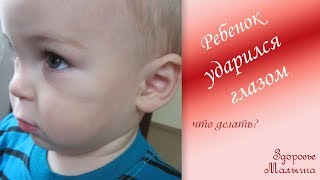 Ребенок ударился глазом: что делать?