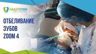 Отбеливание зубов ZOOM4 ? Противопоказания лазерного отбеливания зубов