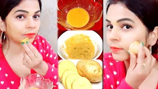1 ही दिन में चेहरे को इतना गोरा कर देगा यह आलू | आलू में यह मिला कर लगालो चेहरा बेदाग खूबसूरत हो जाय