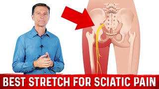 The Best Stretch for Sciatic Pain