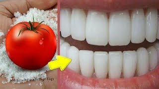 টমেটো ও লবন দিয়ে মাত্র 15 সেকেন্ডে হলদে ও কালো দাঁত ঝকঝকে সাদা করার উপায়।Teeth Whitening at home