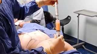 parte 1: Lipoabdominoplastia - Dr. Jorge Azocar
