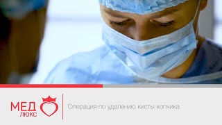 Операция по удалению кисты копчика