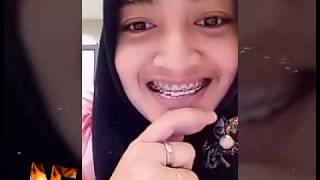 bigo live hot girls Indonesia hot" ml imo video call hot girls Indonesia video recording #129