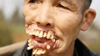 10 САМЫХ СТРАШНЫХ БОЛЕЗНЕЙ