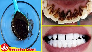 In Nur 5 Minuten - Dieser Trick Wird Ihnen Helfen, Zu Hause Schnell Zahnbelag Zu Entfernen
