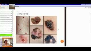 Драгобецкая Инна Павловна - "Дерматоонкология, новообразования кожи"