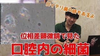【閲覧注意】口腔内細菌を顕微鏡で見ました。ロイテリ菌の話もあるよ。