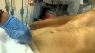 FAST Exam Part 4: Pelvis