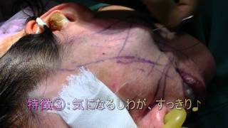 美乳豊胸 美脚くびれ脂肪吸引 二重専門 美容整形 口コミ 湘南美容外科 東京銀座院 長谷川院長 芸能人 モデル アイドル ダイエット バストアップ 若返り アイプチ 埋没法 新宿 池袋 渋谷
