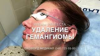 УДАЛЕНИЕ ГЕМАНГИОМЫ НА ЛИЦЕ. VBEAM PERFECTA. ОКСФОРД МЕДИКАЛ ОДЕССА