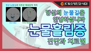 [여의도빛소망TV] 줄줄 흐르는 눈물, 혹시 당신도 눈물흘림증을?!