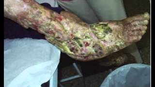 INCRÍVEIS BENEFÍCIOS DA CURA PELA AUTO HEMOTERAPIA HEIWAKI Recorde do teu verdadeiro Ser!